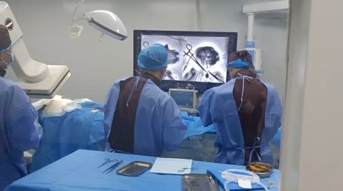全球首例 北京成功完成非人灵长类动物介入式脑机接口试验